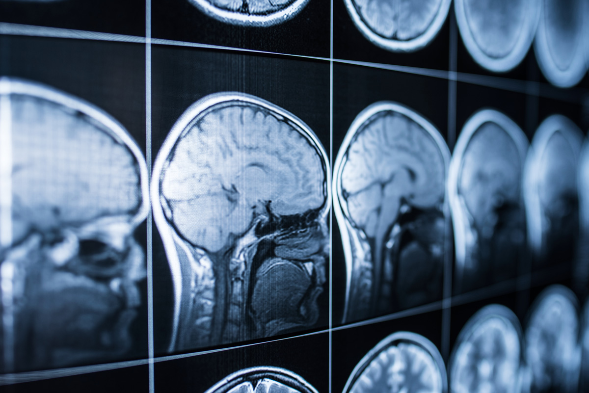 The Most Common Brain Injuries From Medical Malpractice - Free Legal Info